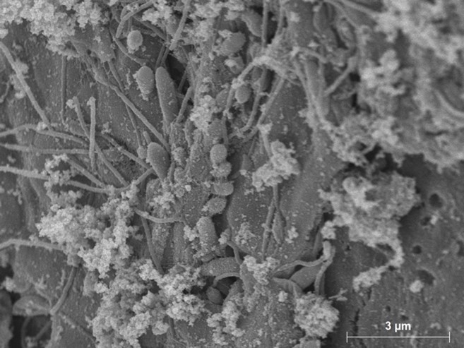 Attaque bactérienne de la surface de plastique biodégradable observée en microscopie électronique (Crédit photo : Yonko Gorand).