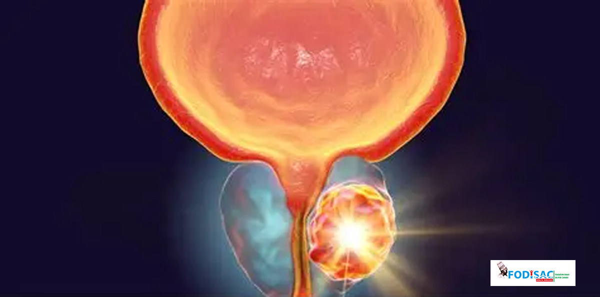 FODISAC – SENSIBILISATION AU CANCER DE LA PROSTATE